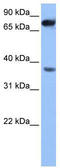 Zinc Finger CCHC-Type Containing 12 antibody, TA337769, Origene, Western Blot image 