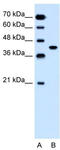 Solute Carrier Family 35 Member B1 antibody, TA333931, Origene, Western Blot image 