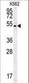 Hedgehog Acyltransferase antibody, LS-C166857, Lifespan Biosciences, Western Blot image 