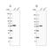 Propionyl-CoA Carboxylase Subunit Beta antibody, NBP1-85886, Novus Biologicals, Western Blot image 