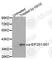 Eukaryotic Translation Initiation Factor 2 Subunit Alpha antibody, AP0342, ABclonal Technology, Western Blot image 