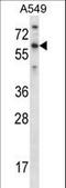 T-Box 21 antibody, LS-C161751, Lifespan Biosciences, Western Blot image 
