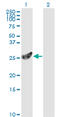 Proteasome Subunit Alpha 7 antibody, LS-B9946, Lifespan Biosciences, Western Blot image 