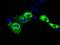 Insulin Like Growth Factor 2 MRNA Binding Protein 2 antibody, MA5-25131, Invitrogen Antibodies, Immunocytochemistry image 
