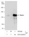 Regulatory Associated Protein Of MTOR Complex 1 antibody, GTX132303, GeneTex, Immunoprecipitation image 