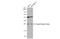 Casein Kinase 2 Beta antibody, GTX101439, GeneTex, Western Blot image 