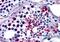 Four And A Half LIM Domains 1 antibody, PA5-18305, Invitrogen Antibodies, Immunohistochemistry paraffin image 