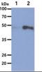 Hexosaminidase Subunit Alpha antibody, NBP2-42629, Novus Biologicals, Western Blot image 