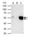 Fli-1 Proto-Oncogene, ETS Transcription Factor antibody, PA5-29597, Invitrogen Antibodies, Immunoprecipitation image 