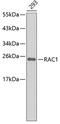 Rac Family Small GTPase 1 antibody, 19-717, ProSci, Western Blot image 