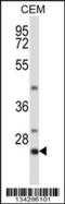 Lck Interacting Transmembrane Adaptor 1 antibody, 57-587, ProSci, Western Blot image 