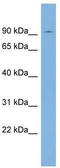 SEC63 Homolog, Protein Translocation Regulator antibody, TA341887, Origene, Western Blot image 