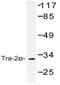 Transformer 2 Alpha Homolog antibody, AP20440PU-N, Origene, Western Blot image 