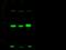 Stratifin antibody, GTX02307, GeneTex, Western Blot image 
