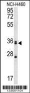 Muscleblind Like Splicing Regulator 3 antibody, 56-840, ProSci, Western Blot image 