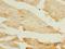 Phosphoinositide-3-Kinase Regulatory Subunit 1 antibody, LS-C376335, Lifespan Biosciences, Immunohistochemistry paraffin image 