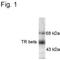 Thyroid Hormone Receptor Beta antibody, MA1-4677, Invitrogen Antibodies, Western Blot image 