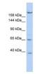 Kinesin Family Member 13B antibody, NBP1-58258, Novus Biologicals, Western Blot image 