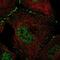 WD Repeat Containing, Antisense To TP73 antibody, NBP1-86851, Novus Biologicals, Immunofluorescence image 