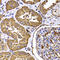 Trimethylguanosine Synthase 1 antibody, A03983, Boster Biological Technology, Immunohistochemistry frozen image 