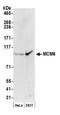 Minichromosome Maintenance Complex Component 6 antibody, NB100-251, Novus Biologicals, Western Blot image 