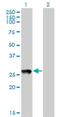 PRELI Domain Containing 1 antibody, H00027166-M01, Novus Biologicals, Western Blot image 