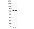 Mitogen-Activated Protein Kinase Kinase Kinase 3 antibody, R31025, NSJ Bioreagents, Western Blot image 