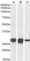 Collagen Type IV Alpha 3 Binding Protein antibody, 45-412, ProSci, Western Blot image 