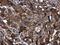 Alpha-1-antitrypsin antibody, GTX112707, GeneTex, Immunohistochemistry paraffin image 