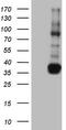 Transforming Acidic Coiled-Coil Containing Protein 2 antibody, CF804148, Origene, Western Blot image 