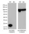 NME/NM23 Nucleoside Diphosphate Kinase 1 antibody, LS-C799238, Lifespan Biosciences, Western Blot image 