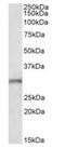 Fibroblast Growth Factor 14 antibody, orb12272, Biorbyt, Western Blot image 
