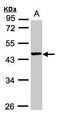 Vacuolar Protein Sorting 72 Homolog antibody, PA5-27626, Invitrogen Antibodies, Western Blot image 