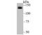 Adenosine Deaminase RNA Specific antibody, A00869-1, Boster Biological Technology, Western Blot image 