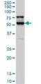 Serine/Threonine Kinase 17a antibody, orb89746, Biorbyt, Western Blot image 