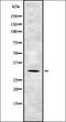Tumor Suppressing Subtransferable Candidate 4 antibody, orb335297, Biorbyt, Western Blot image 