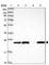 Glutathione S-Transferase Mu 5 antibody, HPA048652, Atlas Antibodies, Western Blot image 