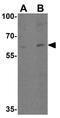 Interleukin 21 Receptor antibody, GTX31270, GeneTex, Western Blot image 
