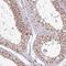 Tyrosine-protein phosphatase non-receptor type 20 antibody, NBP2-46658, Novus Biologicals, Immunohistochemistry frozen image 