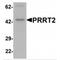 Proline Rich Transmembrane Protein 2 antibody, MBS153605, MyBioSource, Western Blot image 