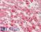 Activin A Receptor Type 1B antibody, LS-B13175, Lifespan Biosciences, Immunohistochemistry paraffin image 