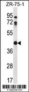 Cathepsin K antibody, 56-632, ProSci, Western Blot image 