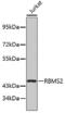 RNA Binding Motif Single Stranded Interacting Protein 2 antibody, 19-268, ProSci, Western Blot image 