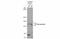 ATP Binding Cassette Subfamily B Member 1 antibody, GTX108370, GeneTex, Western Blot image 