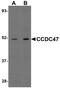 Coiled-Coil Domain Containing 47 antibody, PA5-20856, Invitrogen Antibodies, Western Blot image 