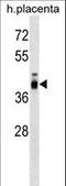 Zona Pellucida Glycoprotein 3 antibody, LS-C157522, Lifespan Biosciences, Western Blot image 