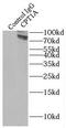 Carnitine Palmitoyltransferase 1A antibody, FNab01942, FineTest, Immunoprecipitation image 