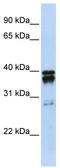 Nudix Hydrolase 18 antibody, TA346832, Origene, Western Blot image 