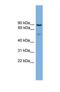 Cornulin antibody, NBP1-57075, Novus Biologicals, Western Blot image 