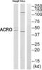Acrosin antibody, abx015546, Abbexa, Western Blot image 